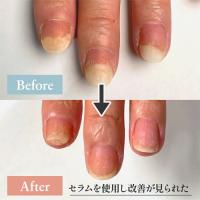 m.Soin ダメージネイルセラム 10ml
