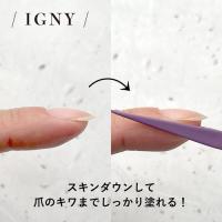 IGNY スキンダウンクリップ 5P